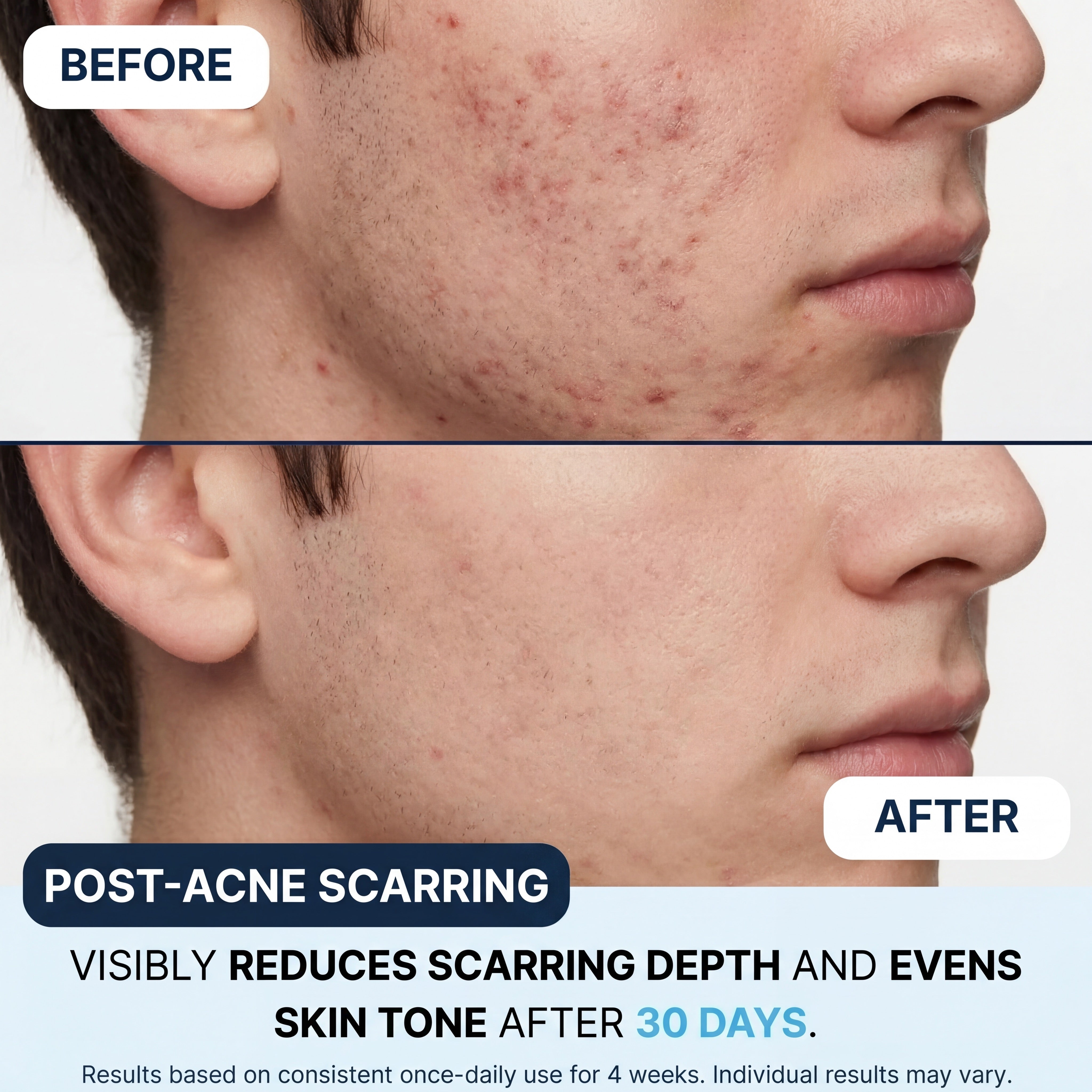 GHK-Cu Copper Peptide Repair Serum